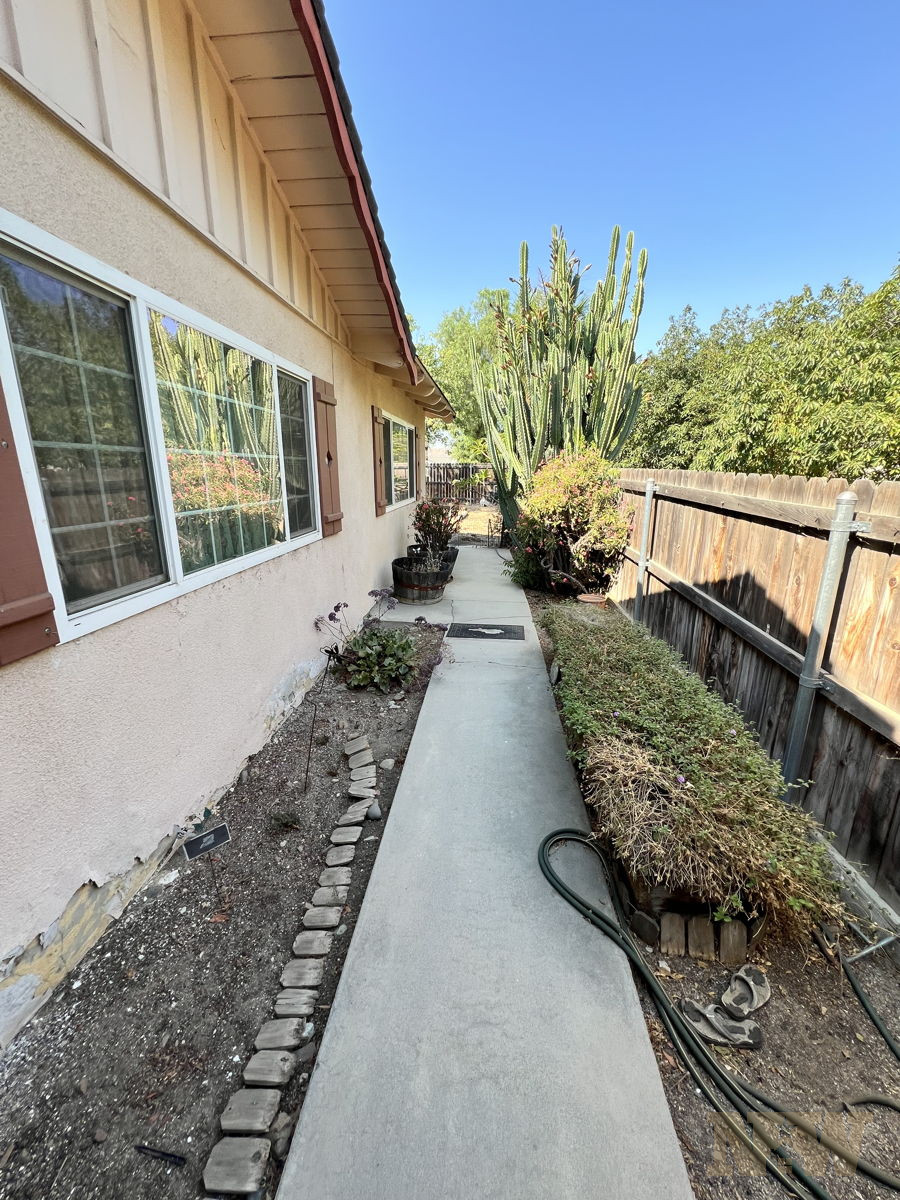 Spacious Corona Fixer with Multiple Exit Strategies